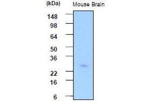 Western Blotting (WB) image for anti-Phosphoserine Phosphatase (PSPH) (AA 1-225), (N-Term) antibody (ABIN317527) (PSPH antibody  (N-Term))