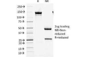 SDS-PAGE Analysis Purified MCM7 Mouse Monoclonal Antibody (MCM7/1466). (MCM7 antibody  (AA 195-319))