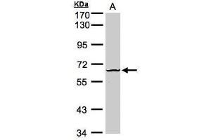 WB Image Sample (30μg whole cell lysate) A:Raji , 7. (DYRK3 antibody)
