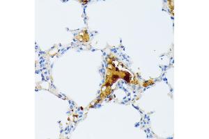 Immunohistochemistry of paraffin-embedded mouse lung using CTRB1 antibody (ABIN7266398) at dilution of 1:100 (40x lens). (CTRB1 antibody  (AA 79-263))