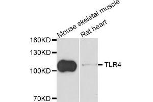 Western blot analysis of extracts of mouse skeletal muscle and rat heart cell lines, using TLR4 antibody. (TLR4 antibody)