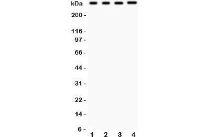 Western blot testing of IP3R antibody and Lane 1:  rat brain;  2: (r) liver;  3: human HeLa;  4: (h) HEPG2. (ITPR3 antibody  (AA 2411-2758))