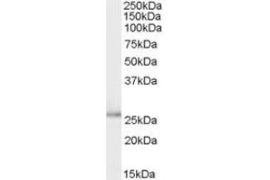 ABIN334515 (0. (TPD52L1 antibody  (Internal Region))