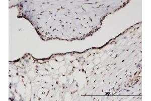Immunoperoxidase of monoclonal antibody to RPS11 on formalin-fixed paraffin-embedded human placenta.