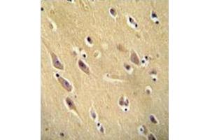 Immunohistochemistry analysis in human brain tissue (formalin-fixed, paraffin-embedded) using CYB561D1 Antibody (C-term), followed by peroxidase conjugation of the secondary antibody and DAB staining.