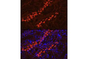 Immunofluorescence analysis of rat kidney using V1B1 Rabbit pAb (ABIN6131094, ABIN6137346, ABIN6137347 and ABIN6222603) at dilution of 1:200 (40x lens). (ATP6V1B1 antibody  (AA 1-280))
