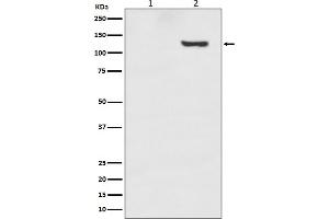 Western blot analysis of Phospho-SIRT1 (T530) expression in (1) 293T cell lysate, (2) 293T cell treated with Calyculin A.
