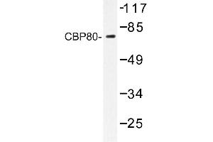 Image no. 1 for anti-Nuclear Cap Binding Protein Subunit 1, 80kDa (NCBP1) antibody (ABIN272218) (NCBP1 antibody)