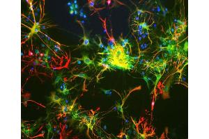 Neuron-glia cell mixture cultures stained with ABIN1842243 (green) and our Rabbit polyclonal antibody against GFAP: RPCA-GFAP (red). (Aldehyde Dehydrogenase H1L1 antibody)