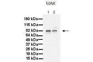 Lanes:   1. (MAK antibody  (C-Term))