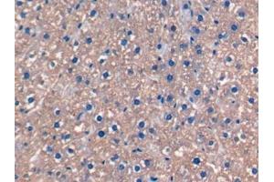 Detection of FGF15 in Rat Liver Tissue using Monoclonal Antibody to Fibroblast Growth Factor 15 (FGF15) (FGF15 antibody  (AA 25-218))