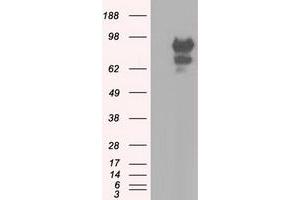 Western Blotting (WB) image for anti-Sorting Nexin 9 (SNX9) antibody (ABIN1501049)