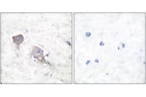 Immunohistochemistry analysis of paraffin-embedded human brain tissue, using SNAP25 Antibody. (SNAP25 antibody  (AA 151-200))
