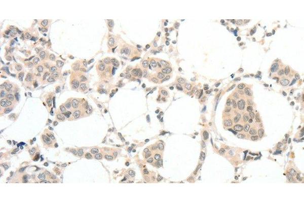 TSPY-Like 2 antibody