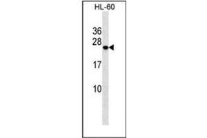 Western blot analysis of PCTP Antibody (Center) in HL-60 cell line lysates (35ug/lane). (PCTP antibody  (Middle Region))