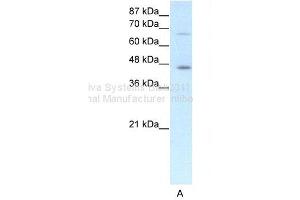 WB Suggested Anti-ESR2 Antibody Titration: 1. (ESR2 antibody  (N-Term))