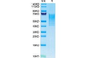SDS-PAGE (SDS) image for AXL Receptor tyrosine Kinase (AXL) (AA 33-442) protein (His tag) (ABIN7273881)