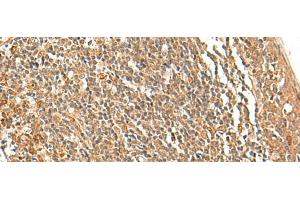 Immunohistochemistry of paraffin-embedded Human tonsil tissue using TSHB Polyclonal Antibody at dilution of 1:40(x200) (TSHB antibody)