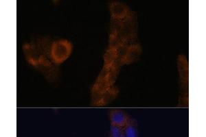 Immunofluorescence analysis of A-431 cells using RPL23A Polyclonal Antibody at dilution of 1:100. (RPL23A antibody)