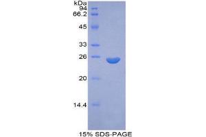 SDS-PAGE (SDS) image for Coagulation Factor IX (F9) (AA 61-263) protein (His tag) (ABIN2120825) (Coagulation Factor IX Protein (F9) (AA 61-263) (His tag))