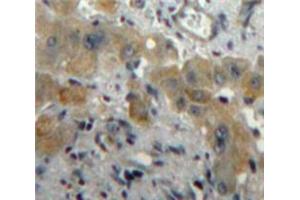 IHC-P analysis of Liver tissue, with DAB staining. (PLGF antibody  (AA 43-162))
