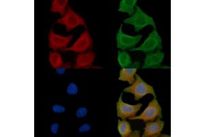ABIN6257782 and ABIN6275437 staining Hela cells(45 min of heat-shock) by IF/ICC.
