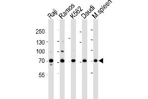Western blot analysis of lysates from Raji, Ramos, K562, Daudi cell line and mouse spleen tissue lysate(from left to right), using BTK Antibody (Center) (ABIN6243554 and ABIN6577451). (BTK antibody  (AA 396-430))