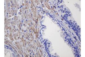 Image no. 3 for anti-Fibronectin Type III Domain Containing 4 (FNDC4) antibody (ABIN1498289)