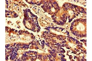 Immunohistochemistry (IHC) image for anti-Cyclin-Dependent Kinase 2 (CDK2) (AA 1-298) antibody (ABIN7148865)