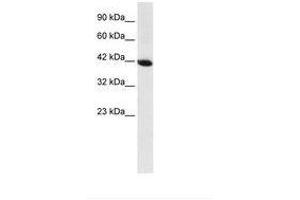 Image no. 1 for anti-Homeobox A13 (HOXA13) (AA 80-129) antibody (ABIN6735847) (HOXA13 antibody  (AA 80-129))