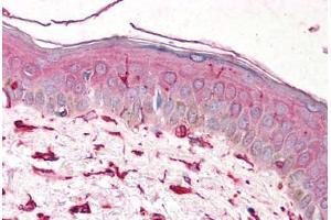Human Skin (formalin-fixed, paraffin-embedded) stained with VIM antibody ABIN239818 at 5 ug/ml followed by biotinylated anti-mouse IgG secondary antibody ABIN481714, alkaline phosphatase-streptavidin and chromogen. (Vimentin antibody)