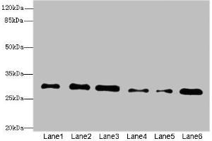 Western blot All lanes: STX7antibody at 2. (Syntaxin 7 antibody  (AA 1-170))