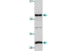 Western blot analysis of human lung tissue with SGK493 polyclonal antibody  at 1 ug/mL dilution. (PKDCC antibody)