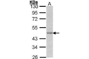 WB Image Sample (30 ug of whole cell lysate) A: A431 , 10% SDS PAGE antibody diluted at 1:1000 (Actin, gamma 1 antibody  (N-Term))