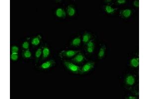 Immunofluorescent analysis of A549 cells using ABIN7176092 at dilution of 1:100 and Alexa Fluor 488-congugated AffiniPure Goat Anti-Rabbit IgG(H+L) (ZMYM3 antibody  (AA 1-495))