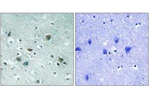 Immunohistochemistry analysis of paraffin-embedded human brain, using CRMP-2 (Phospho-Thr509) Antibody. (DPYSL2 antibody  (pThr509))