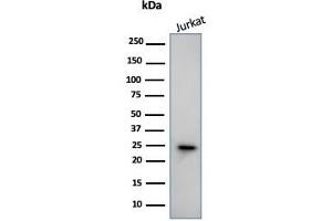 Western Blot Analysis of human Jurkat Cell lysate using CD3e Mouse Monoclonal Antibody (PC3/188A). (CD3 epsilon antibody  (Cytoplasmic Domain))