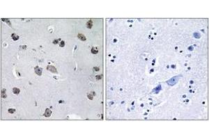 Immunohistochemistry analysis of paraffin-embedded human brain tissue, using MIPT3 Antibody. (TRAF3IP1 antibody  (AA 221-270))