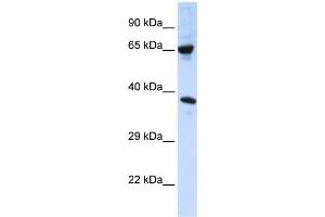 Western Blotting (WB) image for anti-Chromosome 6 Open Reading Frame 134 (C6orf134) antibody (ABIN2458677)