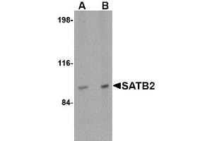 Image no. 1 for anti-SATB Homeobox 2 (SATB2) (N-Term) antibody (ABIN1494405) (SATB2 antibody  (N-Term))