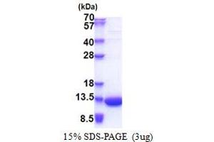 LSM5 Homolog, U6 Small Nuclear RNA Associated (LSM5) (AA 1-91) protein (His tag)
