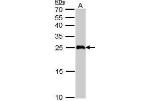 WB Image GSTA1 antibody detects GSTA1 protein by Western blot analysis.