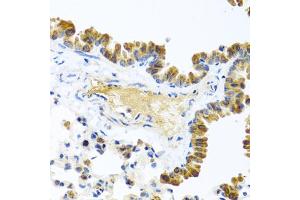 Immunohistochemistry of paraffin-embedded mouse lung using WNT9A antibody. (WNT9A antibody)