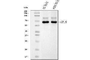 Western blot analysis of Glutaminase/GLS using anti-Glutaminase/GLS antibody (ABIN7601601). (Glutaminase antibody  (AA 396-654))