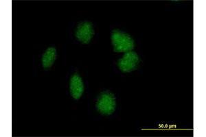 Immunofluorescence of purified MaxPab antibody to POMC on HeLa cell. (POMC antibody  (AA 1-267))