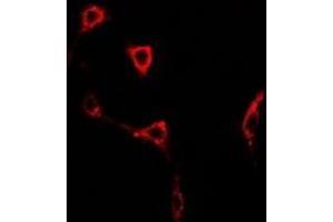 Immunofluorescent analysis of GLUR6 staining in U2OS cells. (GRIK2 antibody)