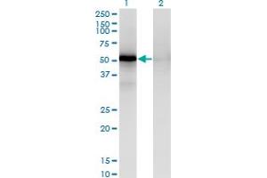 Western Blot analysis of MAPKAPK5 expression in transfected 293T cell line by MAPKAPK5 monoclonal antibody (M02), clone 3D7. (MAPKAP Kinase 5 antibody  (AA 371-471))