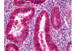 Anti-PCK1 antibody IHC of human uterus, endometrium. (PCK1 antibody)