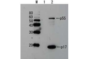 Western Blotting (WB) image for anti-Human Immunodeficiency Virus 1 Matrix (HIV-1 p17) (full length) antibody (ABIN2452017) (HIV-1 p17 antibody  (full length))