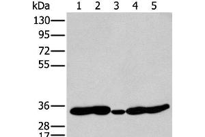 Western blot analysis of 231 Mouse heart tissue Human fetal brain tissue Jurkat and Hepg2 cell using HOXC11 Polyclonal Antibody at dilution of 1:250 (HOXC11 antibody)